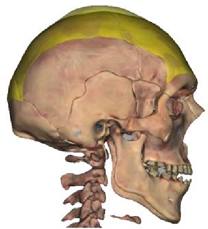 Image of Epicranius (occipitofrontalis) Frontalis & Occipitalis