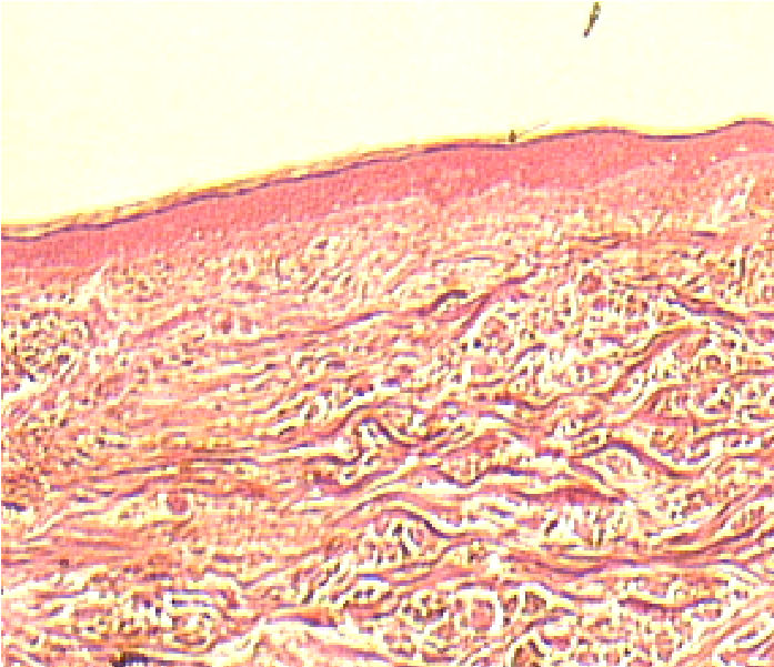 Normal thin skin (for comparison).