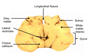 Figure 11 Frontal Section of sheep brain.