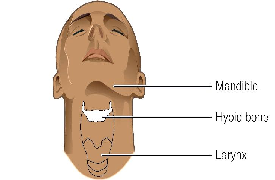 Anterior view of head and neck showing the position of the hyoid bone.