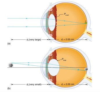 Suspensory ligaments and lens accommodation on focal length (a) far vision, and (b) near vision.