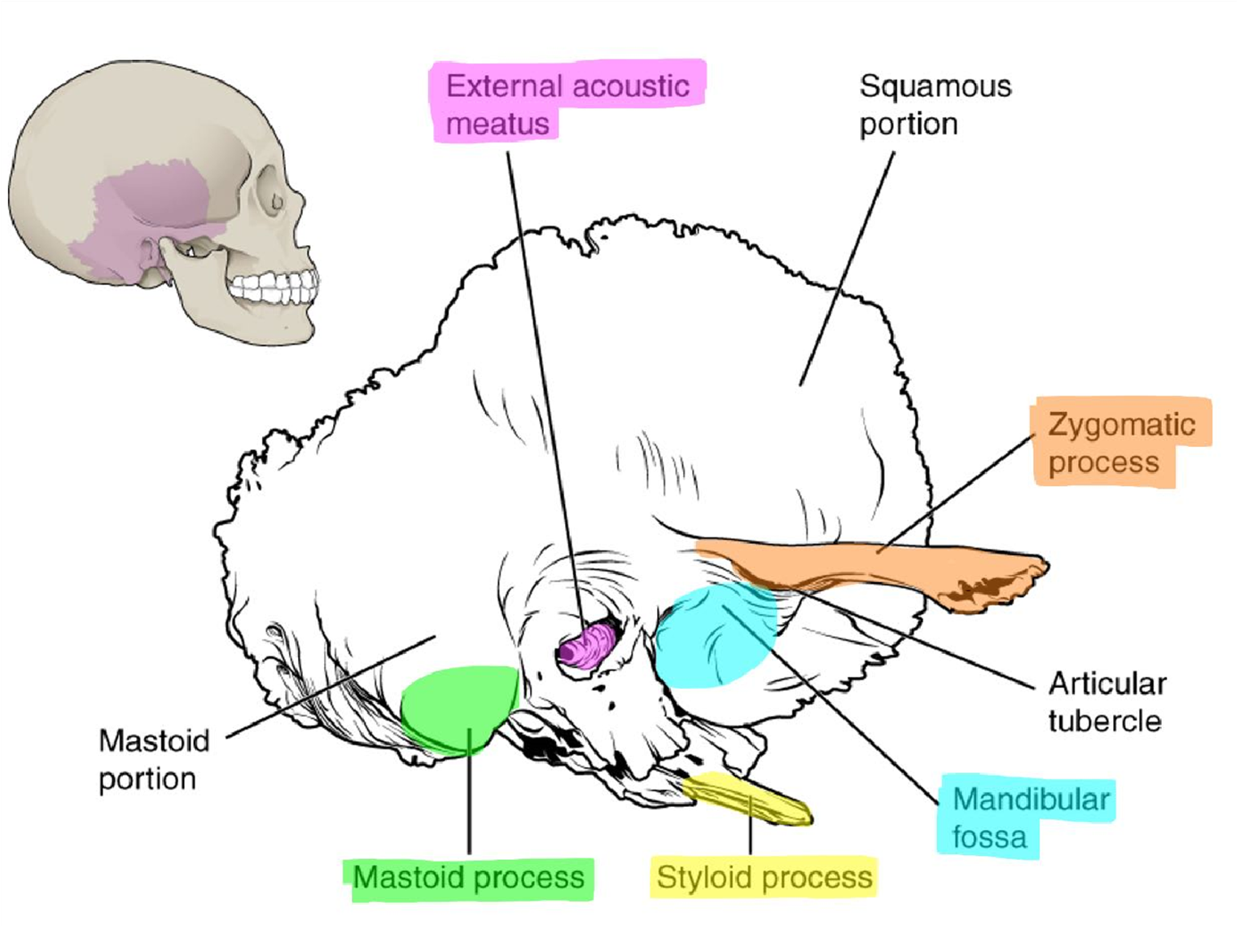 Markings of the temporal bone.