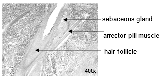 Labeled image of a hair follicle.