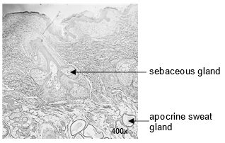 Labeled image showing the glands of the skin.