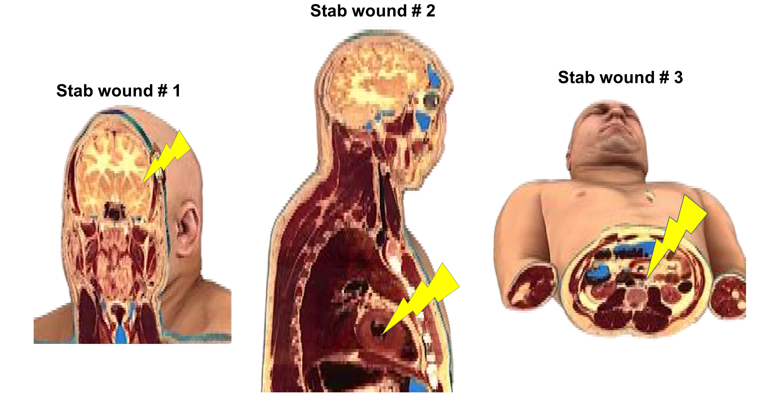 Reconstruction images to mimic CT scans of your patient’s head, thorax, and abdomen.