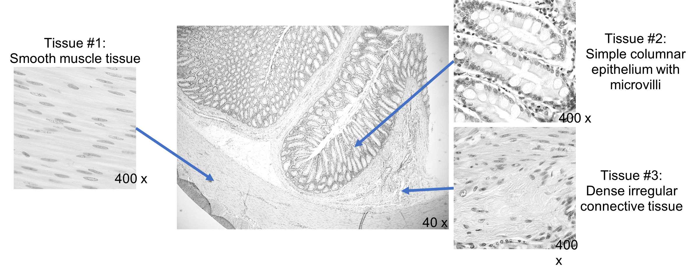 Cross section of the intestine with 3 insets showing the three different types of tissue that compose the wall of the intestines.