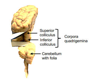 Figure 9 Posterior of sheep brain  illustrating corpora quadrigemina.