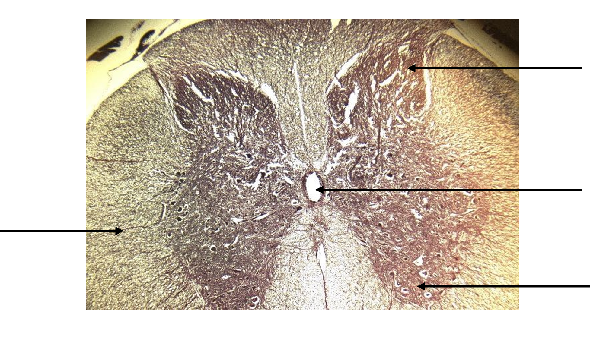 Histological Cross-section of Spinal Cord