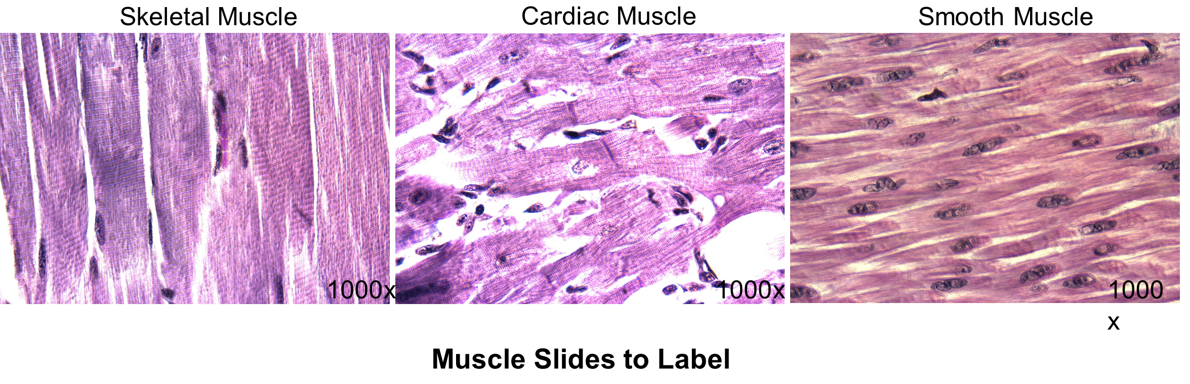 Skeletal, cardiac, and smooth muscle slides to label.