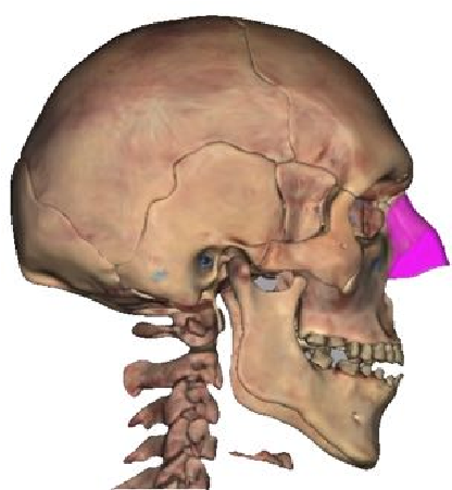 Image of Nasalis muscle.