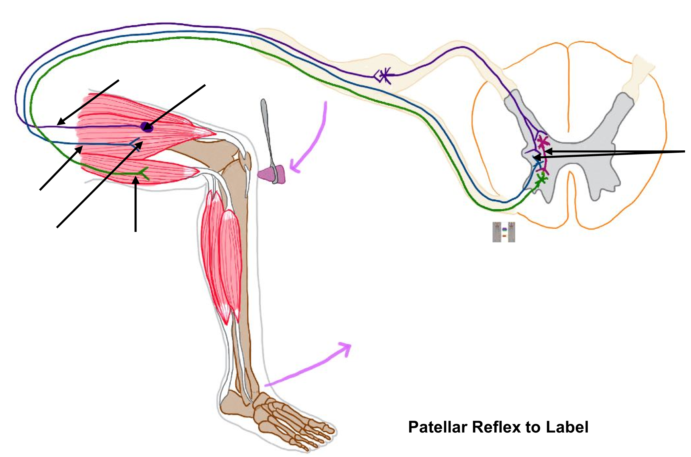 Patellar Reflex to Label