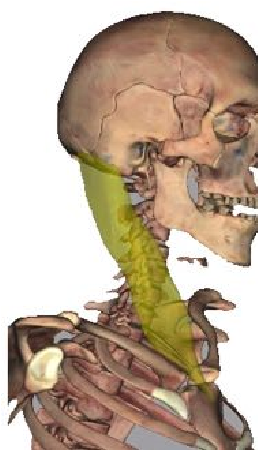 Image of Sternocleidomastoid muscle.