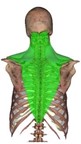 Image of Trapezius (superior section) muscle.