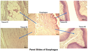 Panel Slides of Esophagus