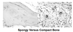 Spongy Versus Compact Bone