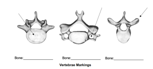 Vertebrae Markings